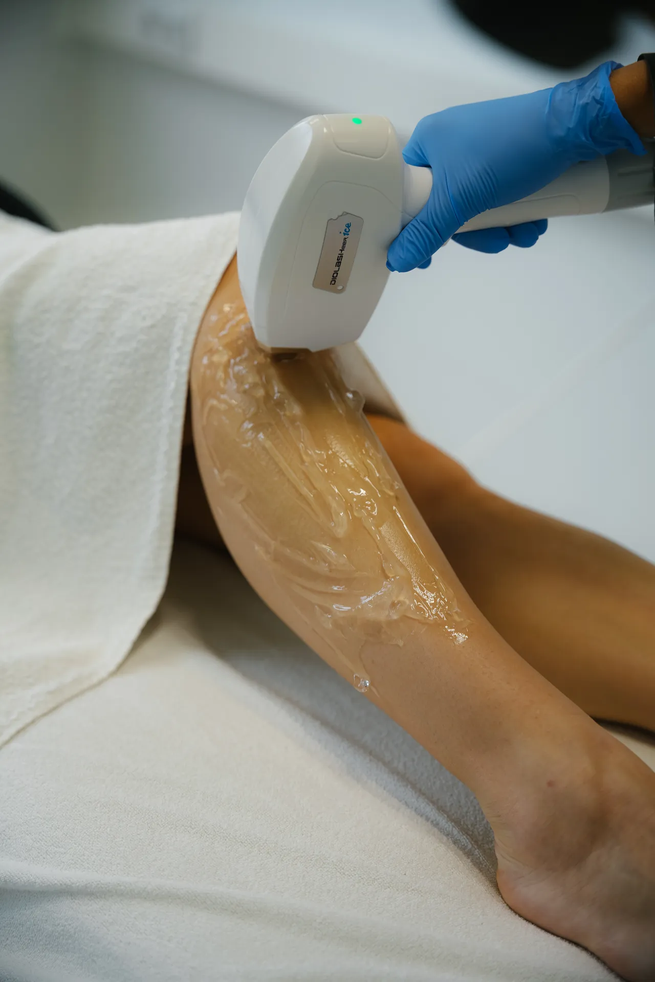Laserontharing benen & voeten · Totalcare Laserclinic Middelburg
